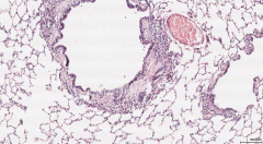 The epithelial cells of the mucosa layer.
