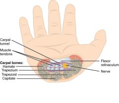 Loft: retinaculum flexorum
Lateralt: eminentia carpi radialis (os scaphoideum+ os trapezium)
Medialt: eminentia carpi ulnaris (os pisiforme + hamalus ossis hamati)
Gulv: håndrodsknoglerne og deres ligamenter