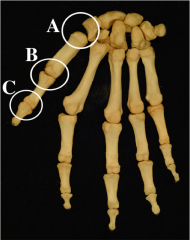 Benævn tommelfingerens tre led og angiv for hvert led mekanisk ledtype samt de bevægelser der kan udføres i leddet