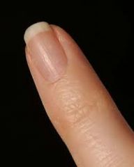 Der Finger