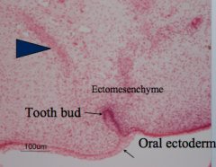 Oral Ectoderm, Neural crest cells


Intramembranous bone formation (no cartilage matrix is needed, bone just forms)