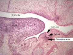 Ectomesenchyme


(note Dental Lamina is oral ectoderm that invaginates inward to form the proliferating tooth bud)
