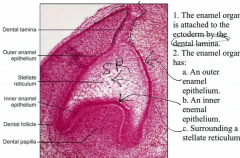 Dental lamina


-Outer enamel epithelium
-Inner enamel epithelium
-Stellate Reticulum (surrounded by the inner)