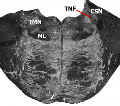 Level of chief sensory nucleus and motor nucleus of trigeminal nerve:
TNF – trigeminal nerve fibers
CSN – Chief sensory nucleus
   (principal sensory nucleus)
TMN –motor nucleus
ML – medial lemniscus