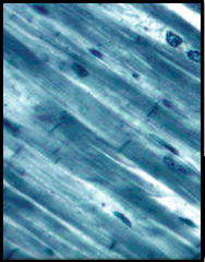 involuntary, striations, 1 or 2 nuclei in center, branching of fibers and intercalated disks