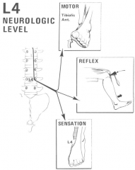 L4 nerve root
