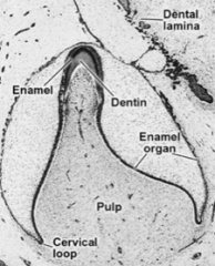 Tooth is no longer connected to oral epithelium
-Fragmentation results in epithelial pearls (or eruption cysts)


Cervical loop
