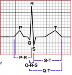"In ECG:

1. What is represented by the P-R interval? And what is a normal time?

2. What does the QRS interval represent? And what is the normal time interval?

3. What does the Q-T interval represent? And what is  the normal time interval...