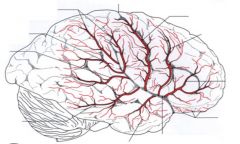 name the artery labeled in red
