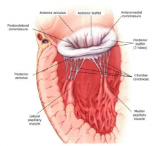 "- Annulus

- Two leaflets (Anterior and Posterior)

- Chordae (attach the leaflets to the papillary muscles)

- Papillary Muscles



Separates the left atrium from the left ventricle."