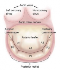 "Aortic valve

The anterior leaflet."