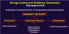 "Pre-renal
Intrinsic renal, and
Post renal."