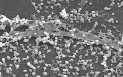 - Aggregations of microorganisms adherent to a surface, particularly to a hard surface like bone or teeth or prosthetic materials
- Microorganisms frequently are embedded in matrix they produce called slime or extracellular polymeric substance or...