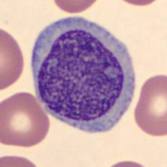 plasmacytoid lymph 