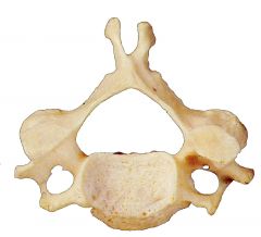Smallest & most superior vertebrae
Extends from the occipital bone of the skull to the thorax.
Supports skull, stabilizes relative positions of brain & spinal cord; allows controlled head movement