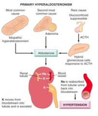 Hyperaldosteronism-a group of closely related conditions characterized by chronic excess aldosterone secretion.  • Hyperaldosteronism may be primary, or it may be secondary to an extra-adrenal cause. 
• Primary hyperaldosteronism stems from an...