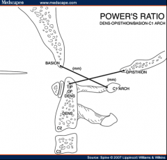 Use power's ratio (should be <1):


Basion to anterior cortex of C1 spinous process


Opisthion to posterior cortex of dens


 


Also Basion-Dens & Basion to posterior axillary line should be <12mm


 