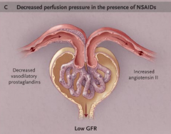 "Decrease GFR.

NSAIDs, cyclosporin, tacrolimus, hypercalcemia, sepsis

Loss of vasodilatory prostaglandins increases afferent resistance; this causes the glomerular capillary pressure to drop below normal values and the GFR to decrease. "
