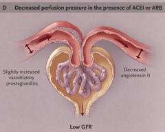 "Decreased GFR & increased serum creatinine

ARB & ACEi

Loss of angiotensin II action reduces efferent resistance; this causes the glomerular capillary pressure to drop below normal values and the GFR to decrease."