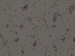 • gram negative organism
• rod, coccobacillary form, singles, pairs, short chains
• live organism growth
• grown at 37° C
• grown on nutrient agar
Example of a Gram Stain