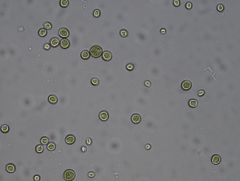 • photosynthetic cell
• greenish tint, round cells