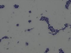 • gram positive organism
• rod arrangement: singles, chains (palisades patter)
• spores - capable of making spores (may or may not be present)
Example of a Simple Stain TCV