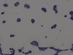 • gram positive organism
• coccus, irregular clusters
• fastidious organism
Example of a Simple Stain TCV