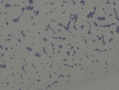 Enterococcus faecalis (newer name)
• gram negative organism
• coccus, pairs, short chains
Example of a Simple Stain TCV