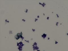 • gram positive organism
• coccus, box cars (pairs of 8)
• lutea means yellow
Example of a Simple Stain TCV