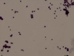 • gram positive
• box cars (8s)
Example of a Gram Stain