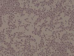 • gram negative
• light pinkish color
• small cells
• rod - coccibacilliary
• grown at 37° C
Example of a Gram Stain