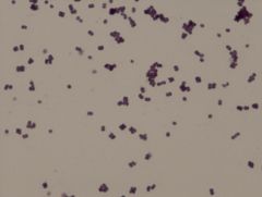 • gram positive
• tetrads
Example of a Gram Stain
