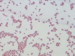 • gram negative rods
• coliform: grows in the intestines
• grown at 37° C
Example of a Gram Stain