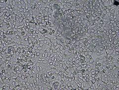 Saccharomyces cerevisiae
400x wet mount