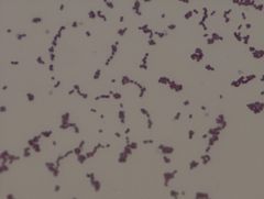 Streptococcus faecalis
gram stain