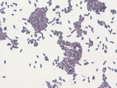 Escherichia coli
cell wall stain