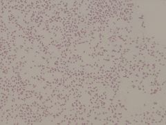 Flavobacterium capsulatum
gram stain