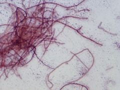 Streptomyces albus
gram stain