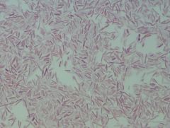 Salmonella anatum
gram stain