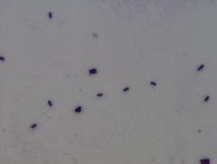 Bacillus subtilis
gram stain