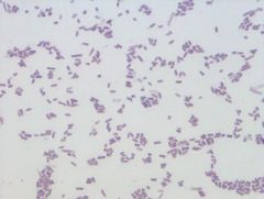 Proteus mirabilis
gram stain