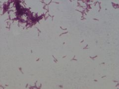 Mycobacterium phlei
gram stain