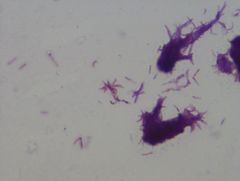 Mycobacterium smegmatis
gram stain