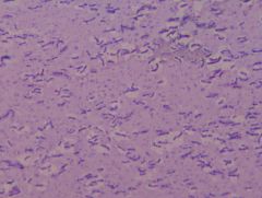 Flavobacterium capsulatum
capsule stain