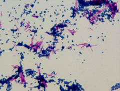 Mycobacterium smegmatis/Staphylococcus aureus
acid fast stain