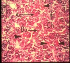 This is a higher magnification of the Anterior Pituitary. 
**See the endocrine table for the hormones and functions.**