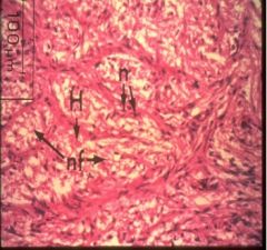 • This is a higher magnification of the Posterior Pituitary.  Note the many nerve fibers (nf). 
**See Table for hormones.**