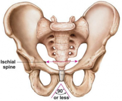 Is this a female pelvic girdle or a male pelvic girdle? 