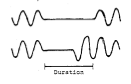 Øverste graf viser luftstrøm, nederste viser respirasjonsbevegelser. Hvilken apné tyder dette bildet på?