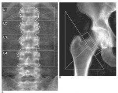 - Lumbar spine
- Hip
- Also radius, ulna, calcaneus, and phalanges can be used
